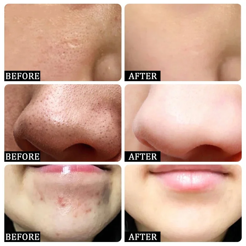 Salicylic Acid Pore Clearing C – Korean Skincare Routine recenzja i cena