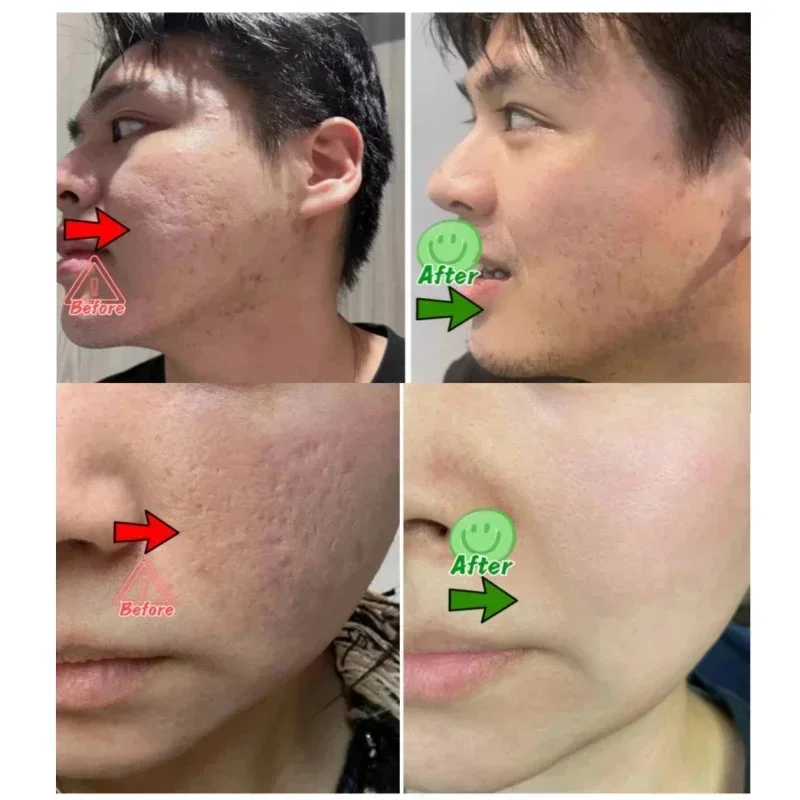 Salicylic Acid Pore Clearing C – Korean Skincare Routine recenzja i cena