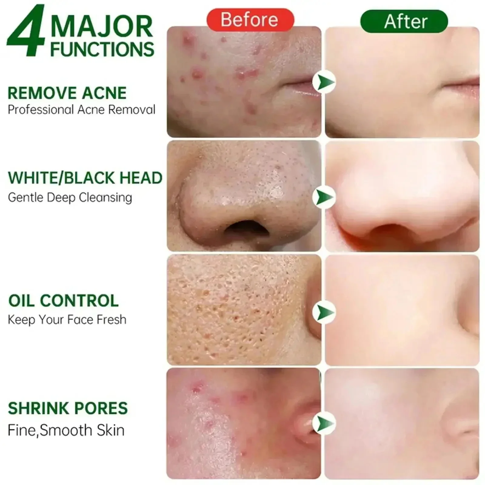Salicylic Acid Pore Clearing C – Korean Skincare Routine recenzja i cena